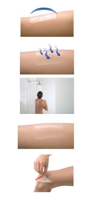 Leukomed T and Leukomed T Plus sterile wound dressings