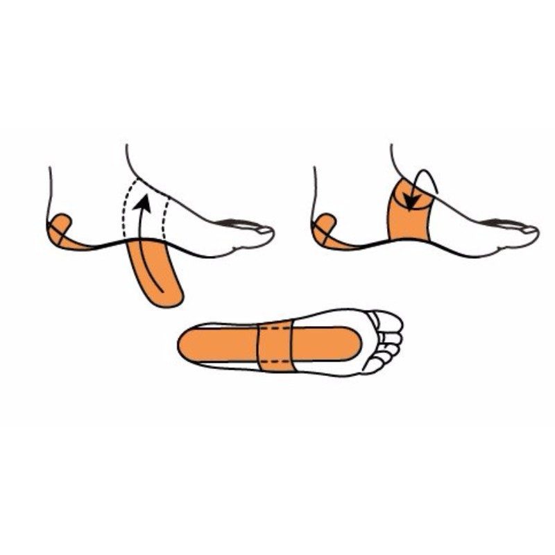 Mueller FasciaDermPFTape - plantar fasciitis pain relief system